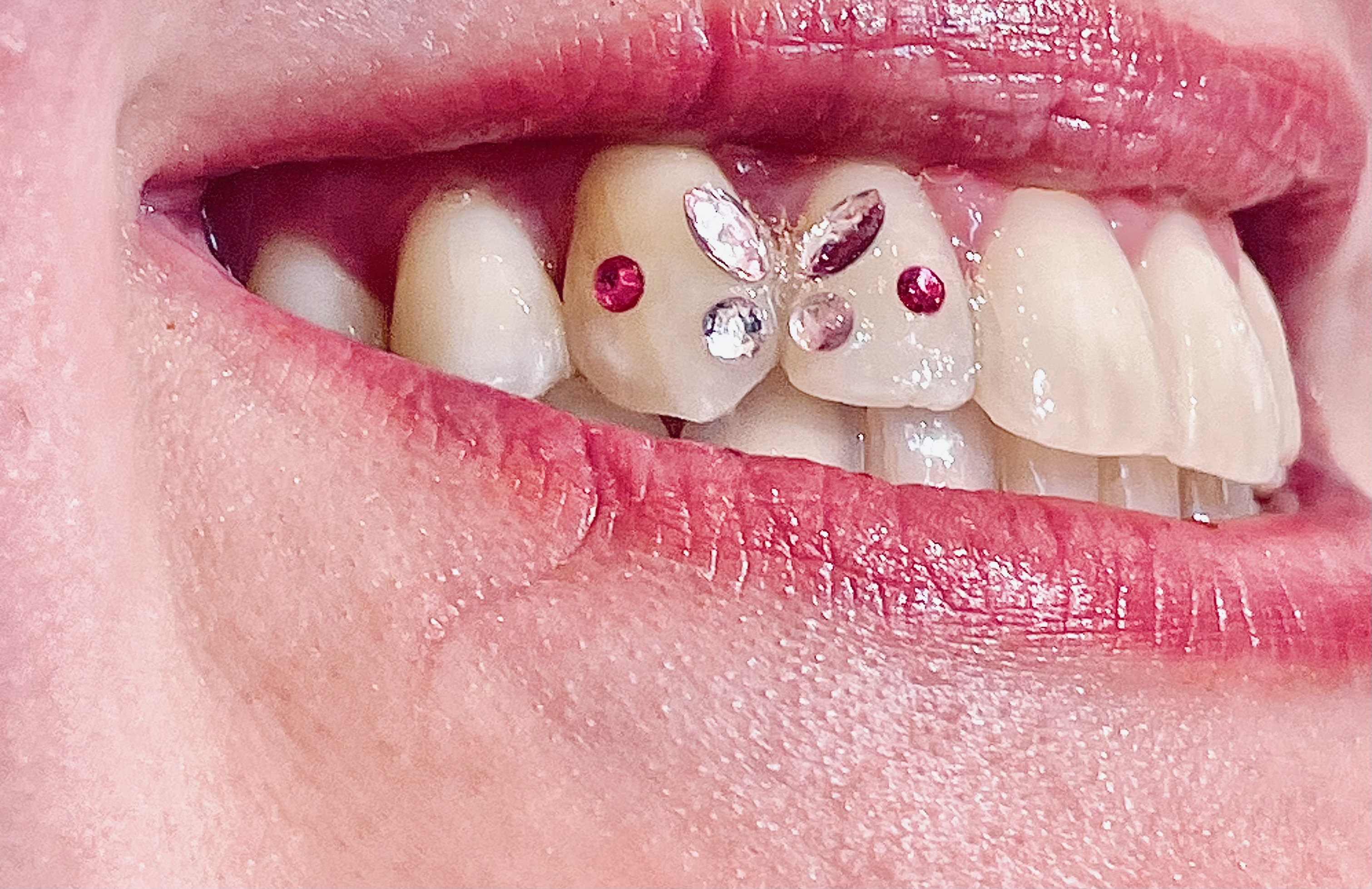 Tooth gem