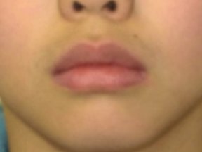 The same child's lips resting closed.