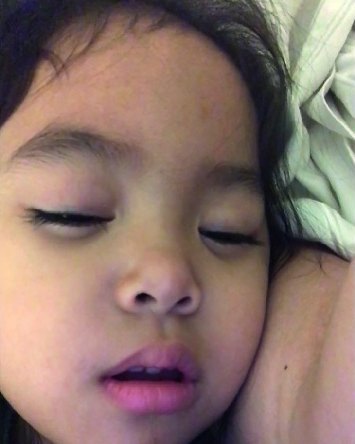 A young girl asleep with her mouth open.
