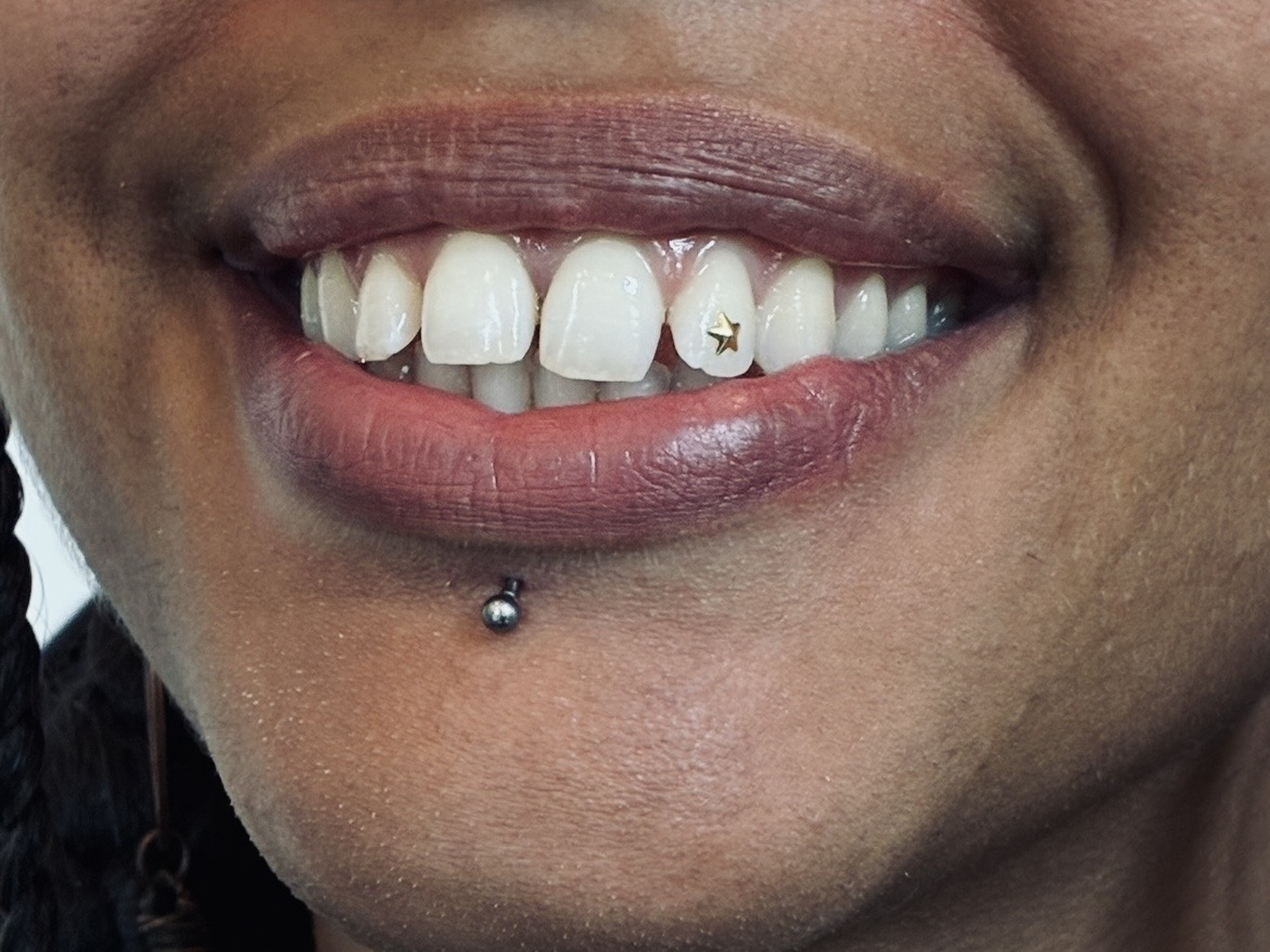 Star tooth gem